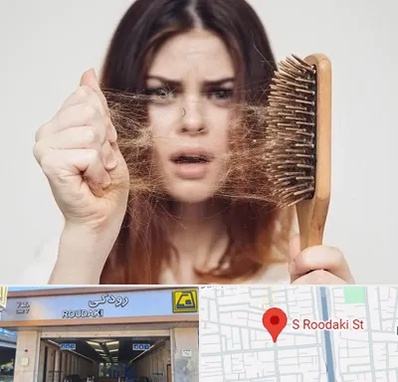 دکتر ریزش مو در رودکی