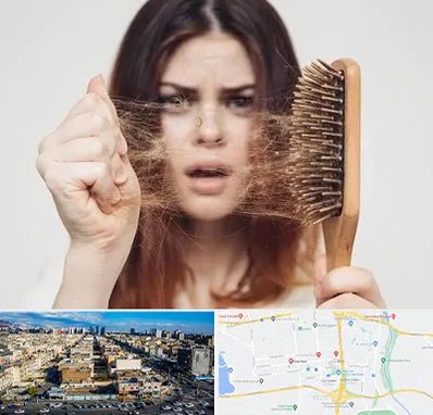 دکتر ریزش مو در شهرک راه آهن