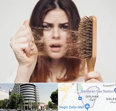 دکتر ریزش مو در قلهک 