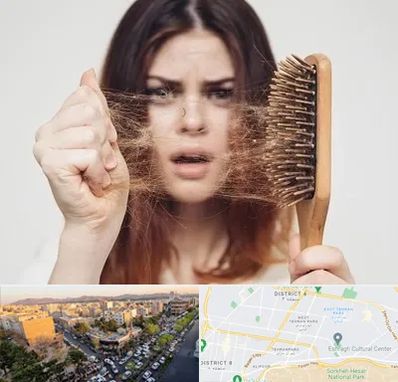 دکتر ریزش مو در تهرانپارس 