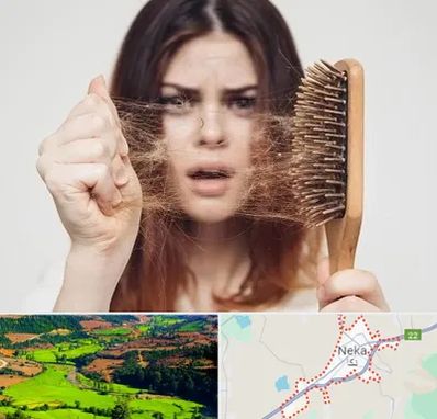 دکتر ریزش مو در نکا