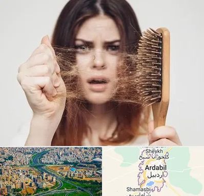 دکتر ریزش مو در اردبیل