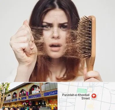 دکتر ریزش مو در 15 خرداد