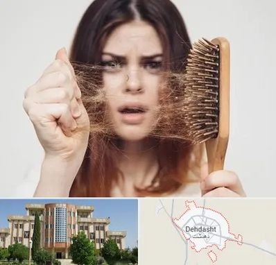دکتر ریزش مو در دهدشت