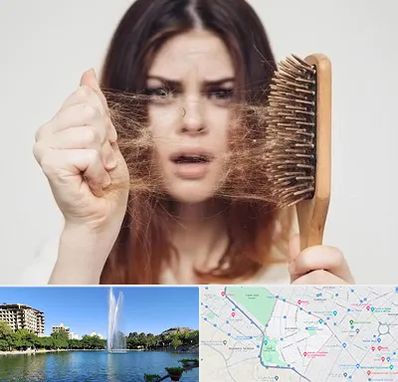 دکتر ریزش مو در کوهسنگی مشهد