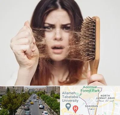 دکتر ریزش مو در شهران 