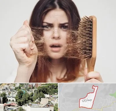 دکتر ریزش مو در جماران