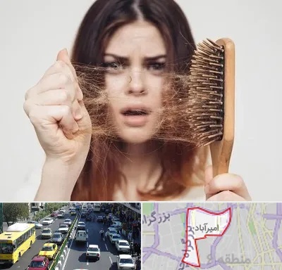 دکتر ریزش مو در امیرآباد