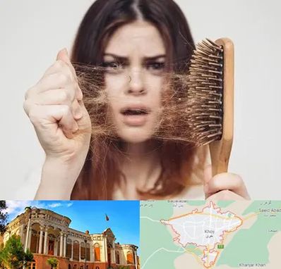 دکتر ریزش مو در خوی