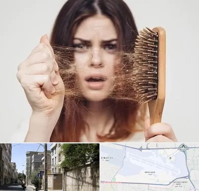 دکتر ریزش مو در مهرآباد