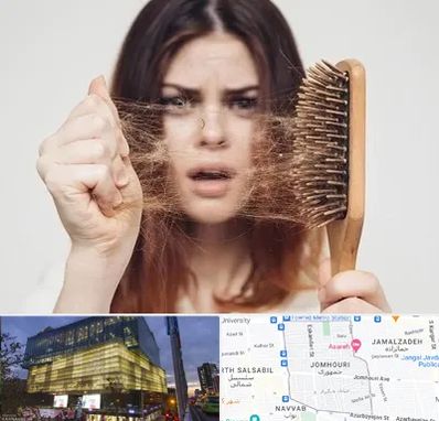 دکتر ریزش مو در جمهوری 