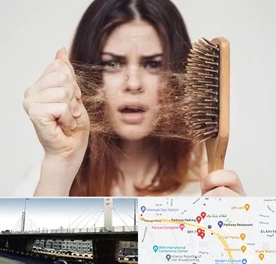 دکتر ریزش مو در پارک وی 