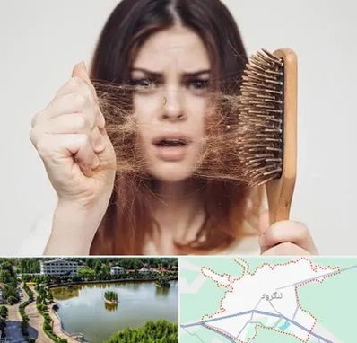 دکتر ریزش مو در لنگرود