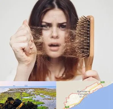 دکتر ریزش مو در بندرلنگه
