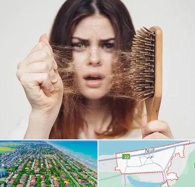 دکتر ریزش مو در نور