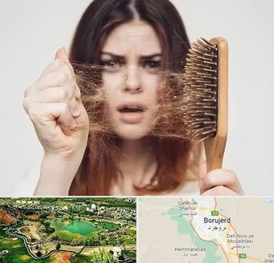 دکتر ریزش مو در بروجرد