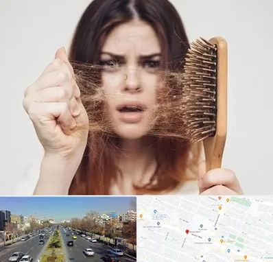 دکتر ریزش مو در بلوار معلم مشهد