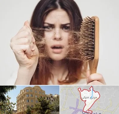 دکتر ریزش مو در مینی سیتی