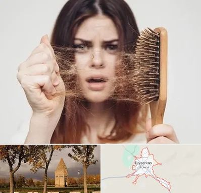 دکتر ریزش مو در تویسرکان