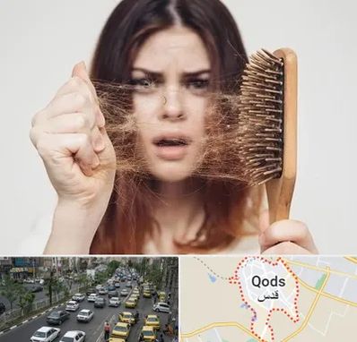 دکتر ریزش مو در شهر قدس