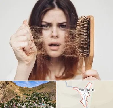 دکتر ریزش مو در فشم