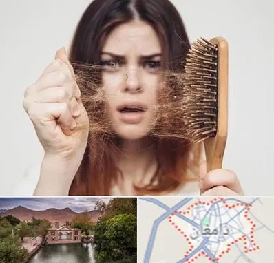 دکتر ریزش مو در دامغان
