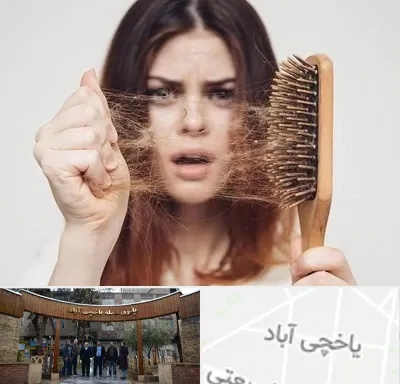 دکتر ریزش مو در یاخچی آباد