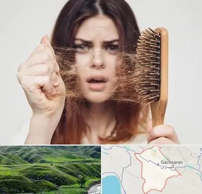 دکتر ریزش مو در گچساران