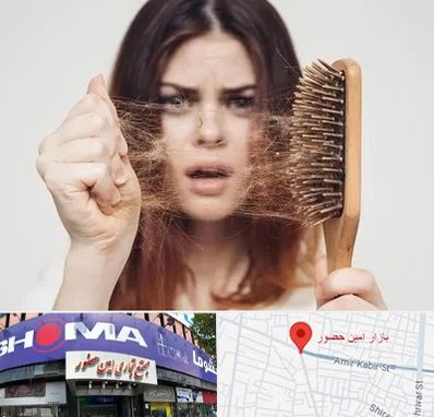 دکتر ریزش مو در امین حضور