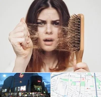 دکتر ریزش مو در بلوار اباذر