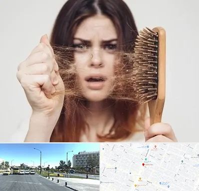 دکتر ریزش مو در بلوار کلاهدوز مشهد