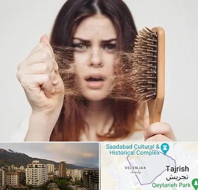 دکتر ریزش مو در زعفرانیه 