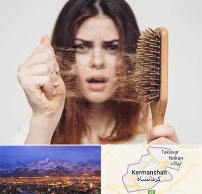 دکتر ریزش مو در کرمانشاه