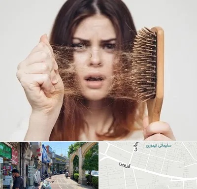 دکتر ریزش مو در خیابان قزوین