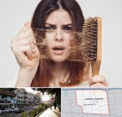 دکتر ریزش مو در خیابان جمالزاده