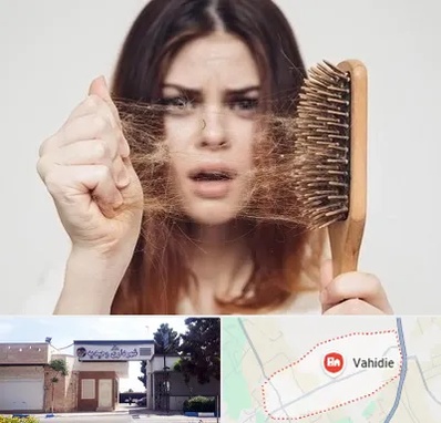 دکتر ریزش مو در وحیدیه شهریار