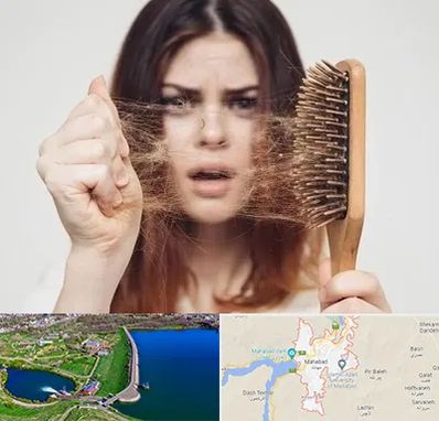 دکتر ریزش مو در مهاباد