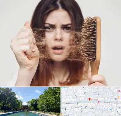دکتر ریزش مو در هشت بهشت اصفهان