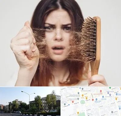 دکتر ریزش مو در میدان کاج 