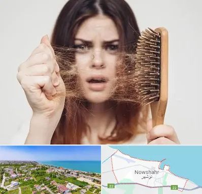 دکتر ریزش مو در نوشهر