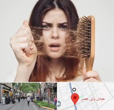 دکتر ریزش مو در ولیعصر شهریار