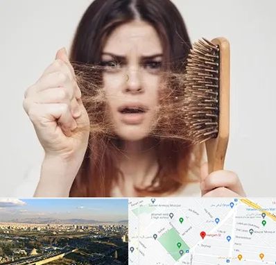 دکتر ریزش مو در هنگام 