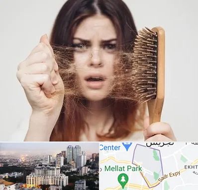 دکتر ریزش مو در الهیه 