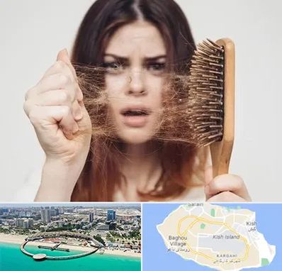 دکتر ریزش مو در کیش