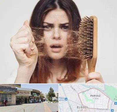 دکتر ریزش مو در پرواز تبریز