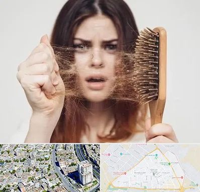 دکتر ریزش مو در قاسم آباد مشهد