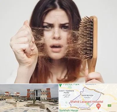 دکتر ریزش مو در حکیمیه 