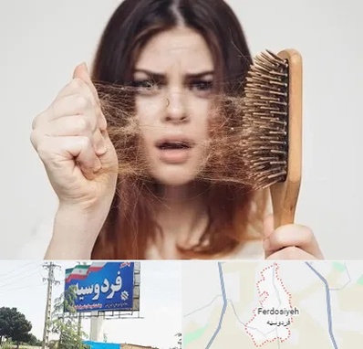 دکتر ریزش مو در فردوسیه شهریار