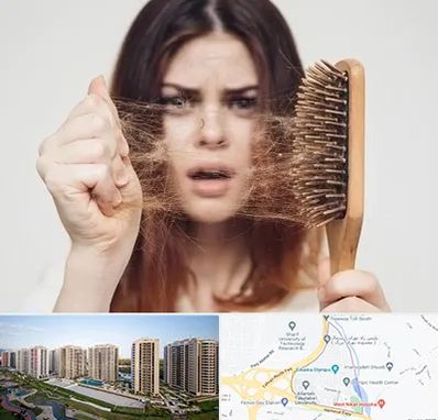 دکتر ریزش مو در المپیک 