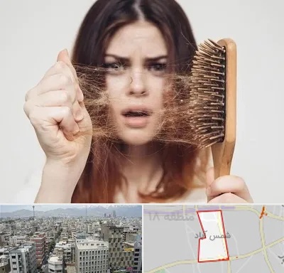 دکتر ریزش مو در شمس آباد تهران